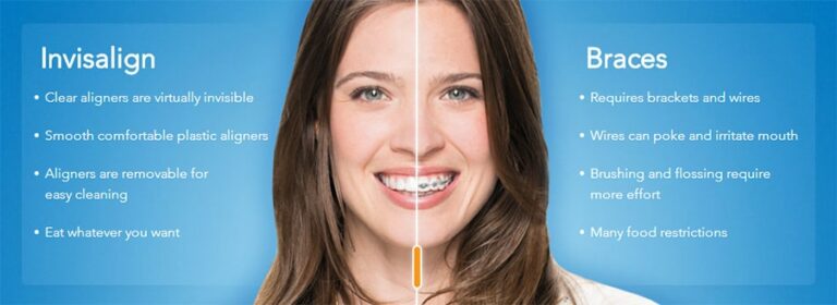 Invisalign-vs-braces